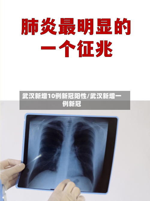 武汉新增10例新冠阳性/武汉新增一例新冠-第2张图片