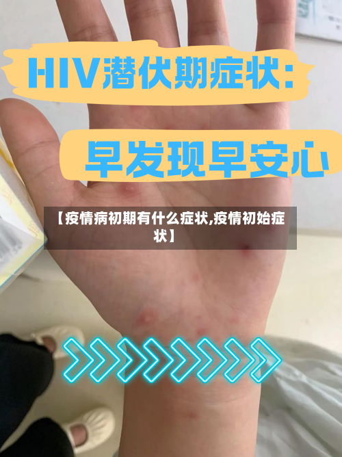 【疫情病初期有什么症状,疫情初始症状】-第2张图片