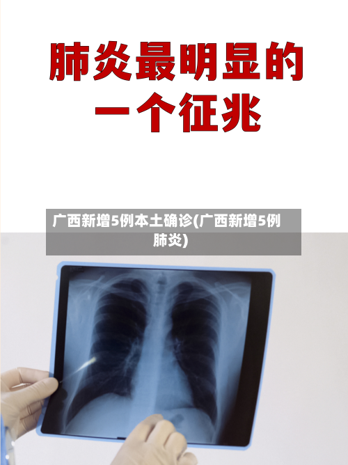 广西新增5例本土确诊(广西新增5例肺炎)-第2张图片